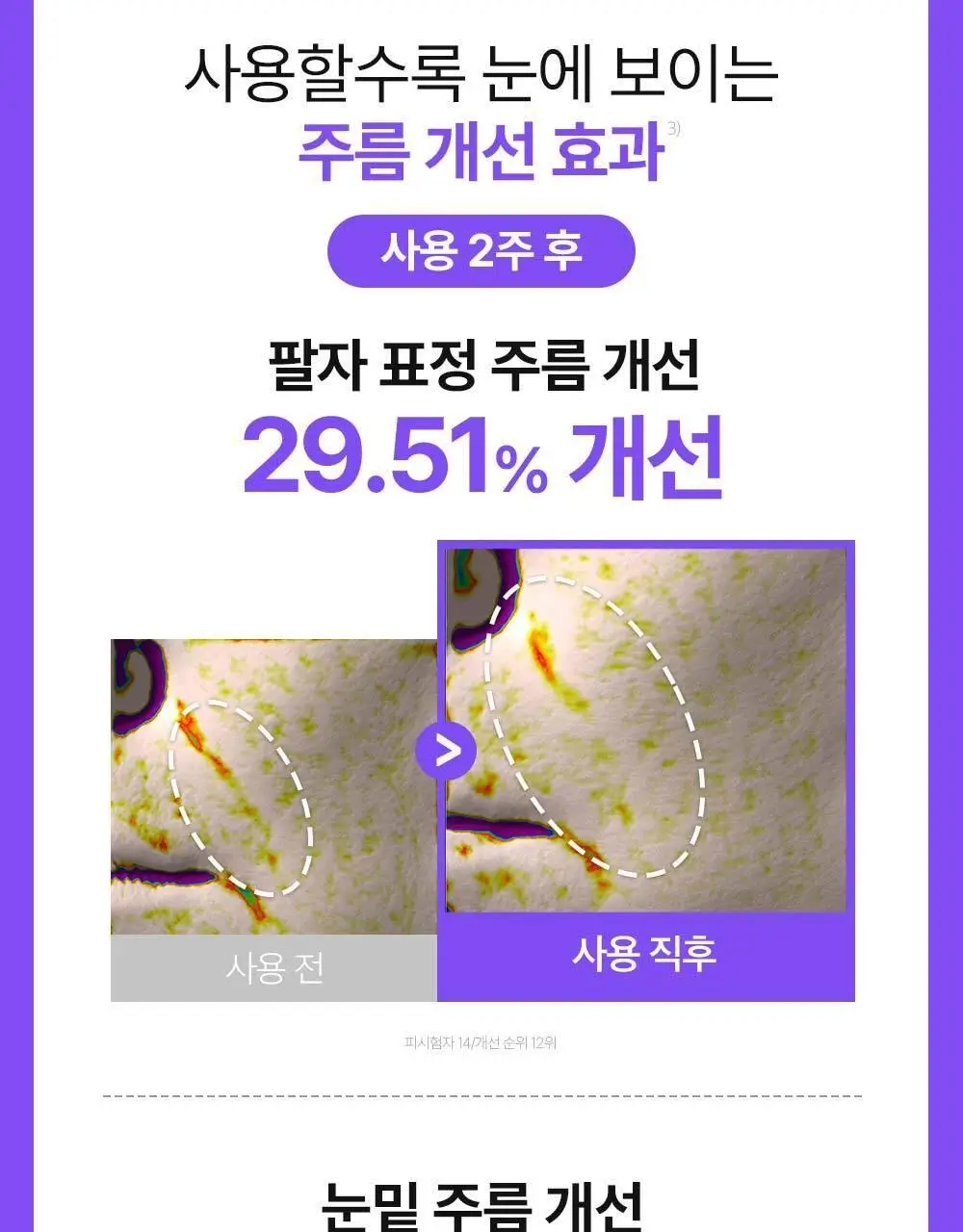 [잡티케어] 더마펌 수딩 리페어 토닝 세럼 R4 30ml 기획 (+리필 30ml) 상세페이지 31